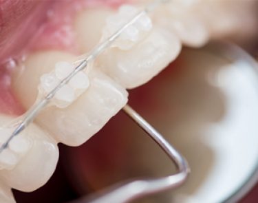 Gallery - Angus Pringle Orthodontics