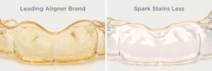Spark stains less compared to leading aligner brand