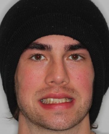 Before Invisalign – adult male with crooked teeth and uneven smile