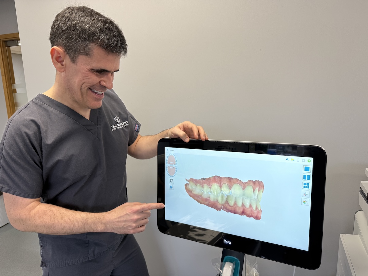 Adult orthodontic treatment planning using digital scanning at Angus Pringle Orthodontics in Fareham, Hampshire