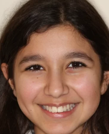 Teen functional appliance fixed braces teeth sticking out before treatment face Fareham